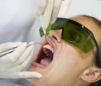Laser treatment for gum disease in Richmond, VA area